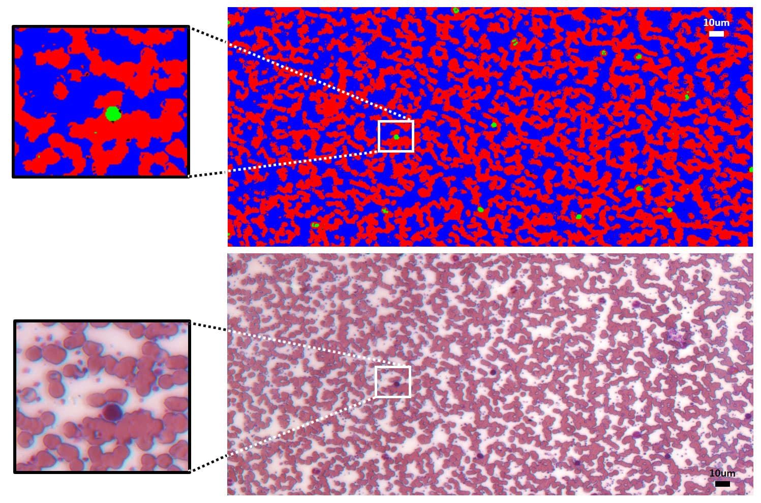 hyperspectral imaging microscopy pathology