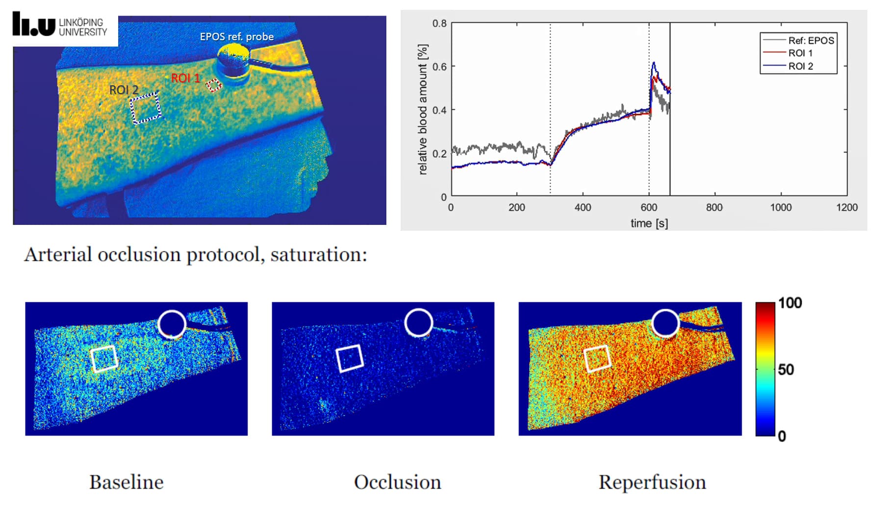 skin perfusion oxygenation snapshot hyperspectral Linkoping