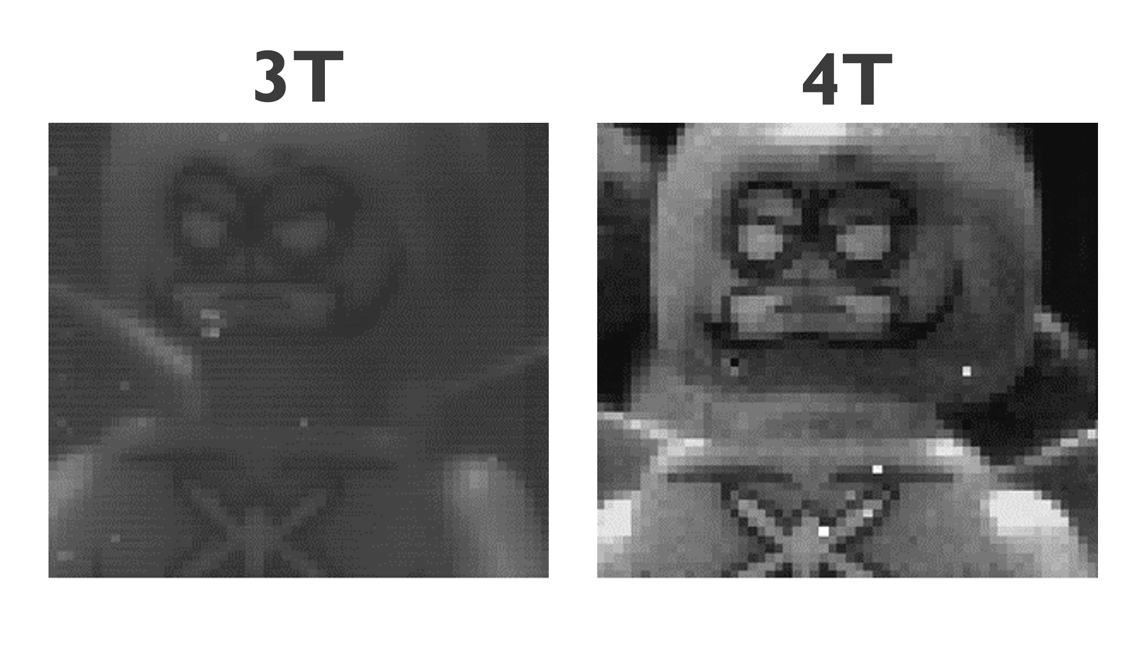 3T 4T comparison