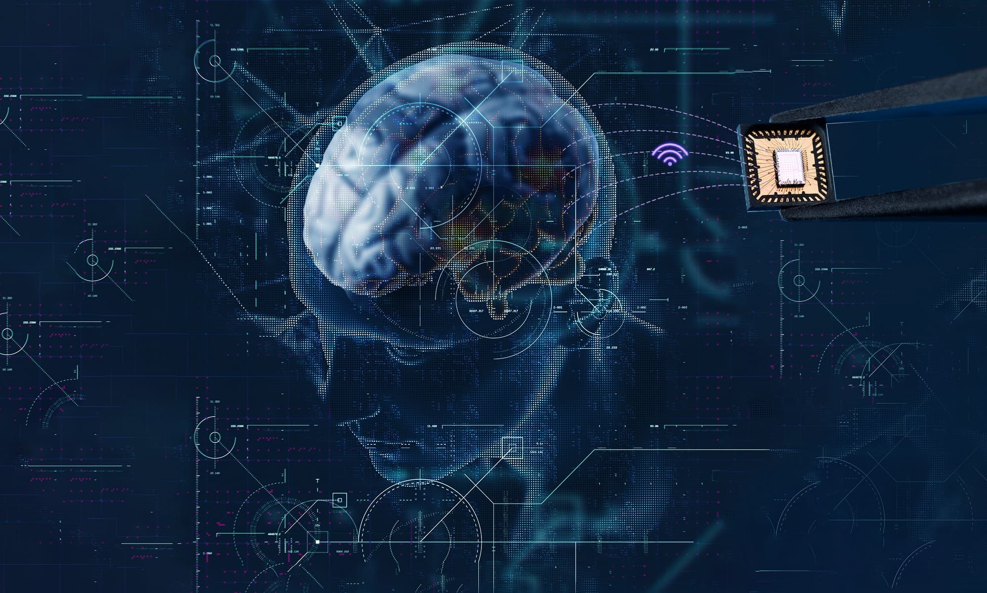 Article Intranet of neurons